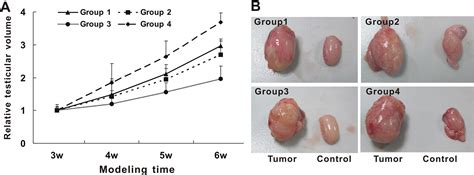 testicular lumps pictures